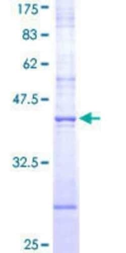 Novus Biologicals Recombinant Human NRF3 GST (N-Term) Protein 25 &mu;g | Buy Online | Novus Biologicals&trade; | Fisher Scientific