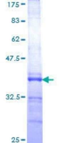 Novus Biologicals Recombinant Human RAB36 GST (N-Term) Protein 10 &mu;g | Buy Online | Novus Biologicals&trade; | Fisher Scientific