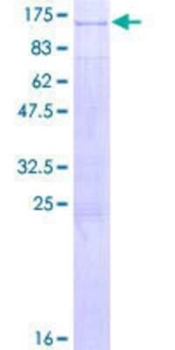 Novus Biologicals Recombinant Human RIN1 GST (N-Term) Protein 2 &mu;g | Buy Online | Novus Biologicals&trade; | Fisher Scientific