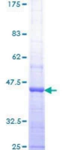 Novus Biologicals Recombinant Human RIN1 GST (N-Term) Protein 10 &mu;g | Buy Online | Novus Biologicals&trade; | Fisher Scientific