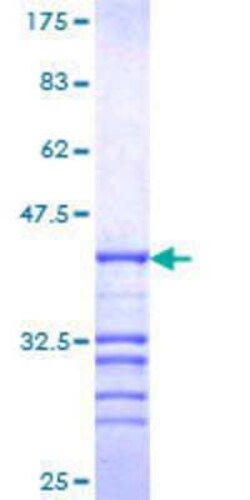 Novus Biologicals Recombinant Human NCOR1 GST (N-Term) Protein 25 &mu;g | Buy Online | Novus Biologicals&trade; | Fisher Scientific