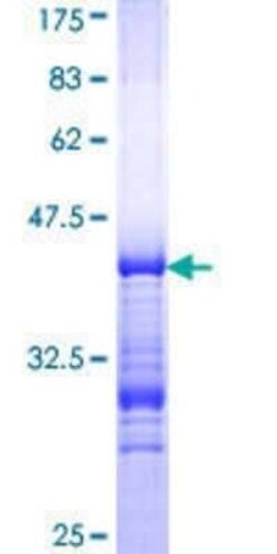 Novus Biologicals Recombinant Human NCOR2 GST (N-Term) Protein 10 &mu;g | Buy Online | Novus Biologicals&trade; | Fisher Scientific