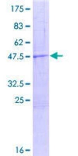 Novus Biologicals Recombinant Human MTRF1 GST (N-Term) Protein 25 &mu;g | Buy Online | Novus Biologicals&trade; | Fisher Scientific
