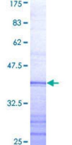 Novus Biologicals Recombinant Human TRAF-4 GST (N-Term) Protein 25 &mu;g | Buy Online | Novus Biologicals&trade; | Fisher Scientific