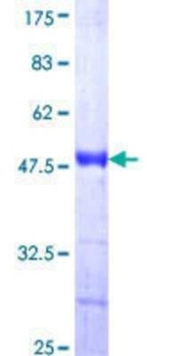 Novus Biologicals Recombinant Human AATK/Serine/threonine-protein kinase LMTK1 GST (N-Term) Protein 10 &mu;g | Buy Online | Novus Biologicals&trade; | Fisher Scientific