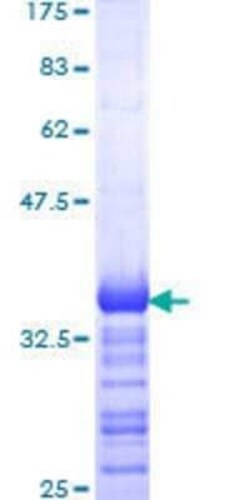 Novus Biologicals Recombinant Human Synphilin-1 GST (N-Term) Protein 25 &mu;g | Buy Online | Novus Biologicals&trade; | Fisher Scientific