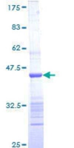 Novus Biologicals Recombinant Human RGS6 GST (N-Term) Protein 10 &mu;g | Buy Online | Novus Biologicals&trade; | Fisher Scientific