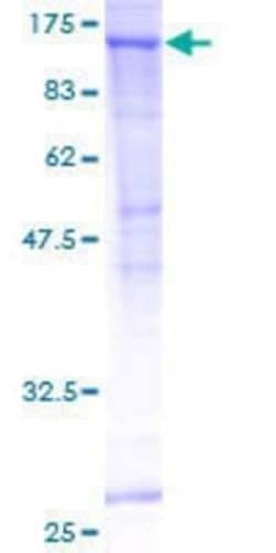 Novus Biologicals Recombinant Human SEC24C GST (N-Term) Protein 10 &mu;g | Buy Online | Novus Biologicals&trade; | Fisher Scientific