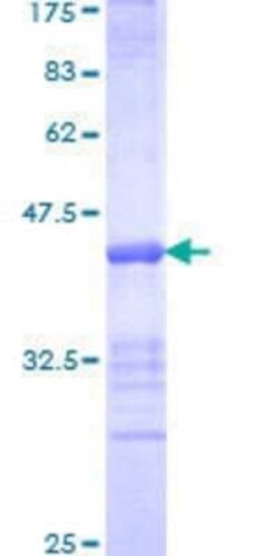 Novus Biologicals Recombinant Human Tesmin GST (N-Term) Protein 25 &mu;g | Buy Online | Novus Biologicals&trade; | Fisher Scientific