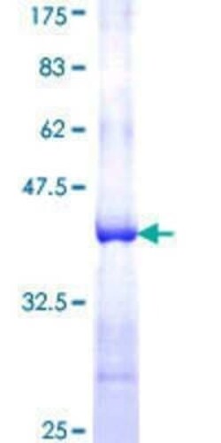 Novus Biologicals Recombinant Human CLCA2 GST (N-Term) Protein 25 &mu;g | Buy Online | Novus Biologicals&trade; | Fisher Scientific