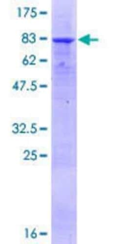 Novus Biologicals Recombinant Human ARHGEF10 GST (N-Term) Protein 25 &mu;g | Buy Online | Novus Biologicals&trade; | Fisher Scientific