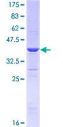 Novus Biologicals Recombinant Human ARHGEF10 GST (N-Term) Protein 10 &mu;g | Buy Online | Novus Biologicals&trade; | Fisher Scientific