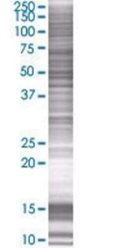 Novus Biologicals ARHGEF10 293T Cell Transient Overexpression Lysate 0.1 mL | Buy Online | Novus Biologicals&trade; | Fisher Scientific
