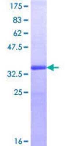 Novus Biologicals Recombinant Human MICAL2 GST (N-Term) Protein 10 &mu;g | Buy Online | Novus Biologicals&trade; | Fisher Scientific