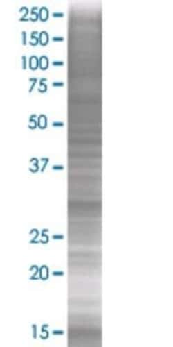 Novus Biologicals RALGPS1 293T Cell Transient Overexpression Lysate 0.1 mL | Buy Online | Novus Biologicals&trade; | Fisher Scientific