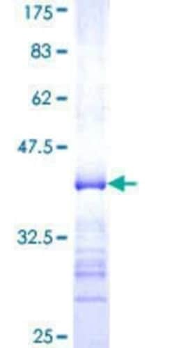 Novus Biologicals Recombinant Human SOCS-5 GST (N-Term) Protein 10 &mu;g | Buy Online | Novus Biologicals&trade; | Fisher Scientific