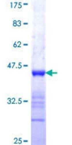 Novus Biologicals Recombinant Human IQCB1 GST (N-Term) Protein 10 &mu;g | Buy Online | Novus Biologicals&trade; | Fisher Scientific