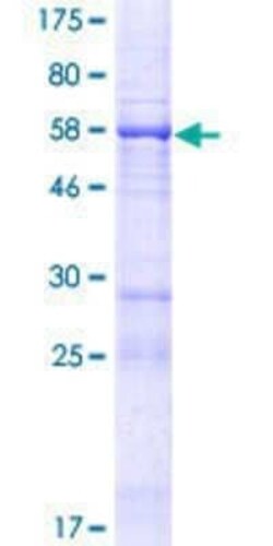 Novus Biologicals Recombinant Human FAM53B GST (N-Term) Protein 25 &mu;g | Buy Online | Novus Biologicals&trade; | Fisher Scientific