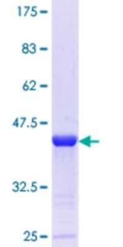 Novus Biologicals Recombinant Human Clathrin interactor 1 GST (N-Term) Protein 25 &mu;g | Buy Online | Novus Biologicals&trade; | Fisher Scientific