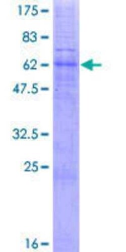 Novus Biologicals Recombinant Human TRAM2 GST (N-Term) Protein 2 &mu;g | Buy Online | Novus Biologicals&trade; | Fisher Scientific