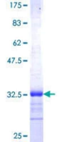 Novus Biologicals Recombinant Human TRAM2 GST (N-Term) Protein 25 &mu;g | Buy Online | Novus Biologicals&trade; | Fisher Scientific