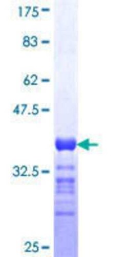 Novus Biologicals Recombinant Human RIMS2 GST (N-Term) Protein 10 &mu;g | Buy Online | Novus Biologicals&trade; | Fisher Scientific