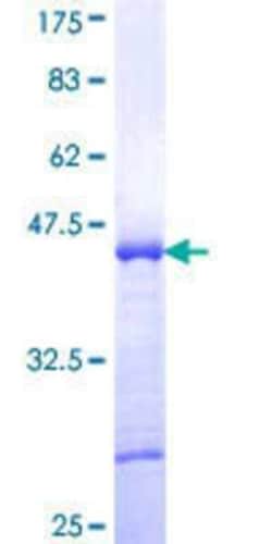 Novus Biologicals Recombinant Human ST18 GST (N-Term) Protein 25 &mu;g | Buy Online | Novus Biologicals&trade; | Fisher Scientific