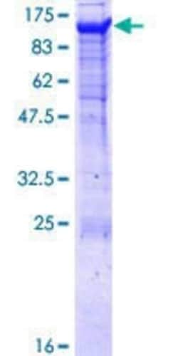Novus Biologicals Recombinant Human Protocadherin gamma A8 GST (N-Term) Protein 25 &mu;g | Buy Online | Novus Biologicals&trade; | Fisher Scientific