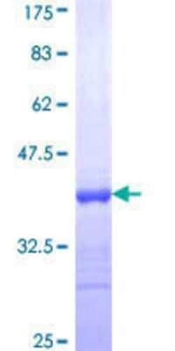 Novus Biologicals Recombinant Human Protocadherin gamma A8 GST (N-Term) Protein 25 &mu;g | Buy Online | Novus Biologicals&trade; | Fisher Scientific