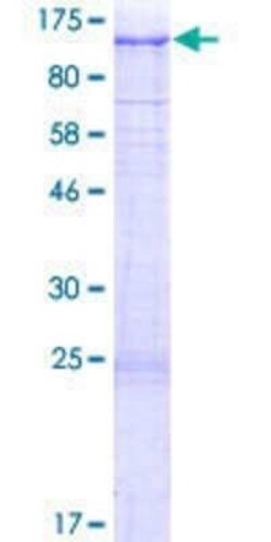 Novus Biologicals Recombinant Human USP6NL GST (N-Term) Protein 2 &mu;g | Buy Online | Novus Biologicals&trade; | Fisher Scientific