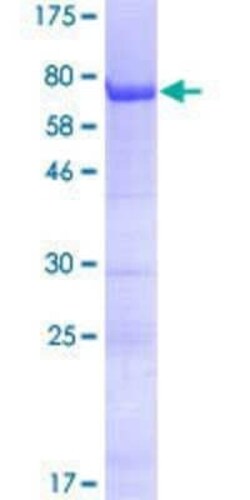 Novus Biologicals Recombinant Human FAM131B GST (N-Term) Protein 2 &mu;g | Buy Online | Novus Biologicals&trade; | Fisher Scientific