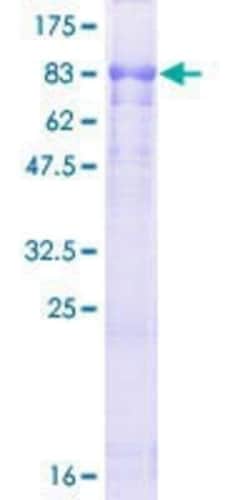Novus Biologicals Recombinant Human NOS1AP GST (N-Term) Protein 10 &mu;g | Buy Online | Novus Biologicals&trade; | Fisher Scientific