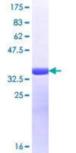 Novus Biologicals Recombinant Human RAB11FIP3 GST (N-Term) Protein 25 &mu;g | Buy Online | Novus Biologicals&trade; | Fisher Scientific