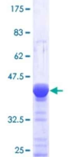 Novus Biologicals Recombinant Human DOCK4 GST (N-Term) Protein 10 &mu;g | Buy Online | Novus Biologicals&trade; | Fisher Scientific