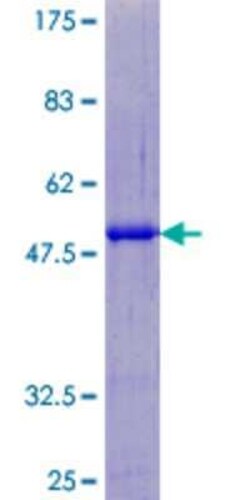 Novus Biologicals Recombinant Human SART3 GST (N-Term) Protein 10 &mu;g | Buy Online | Novus Biologicals&trade; | Fisher Scientific