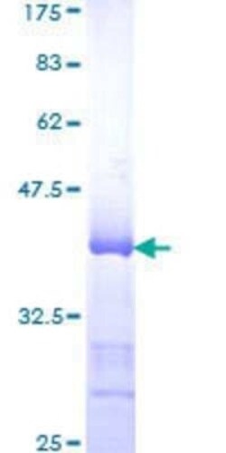 Novus Biologicals Recombinant Human HDAC9 GST (N-Term) Protein 25 &mu;g | Buy Online | Novus Biologicals&trade; | Fisher Scientific