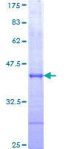 Novus Biologicals Recombinant Human USP34 GST (N-Term) Protein 25 &mu;g | Buy Online | Novus Biologicals&trade; | Fisher Scientific