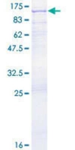 Novus Biologicals Recombinant Human CENTB1 GST (N-Term) Protein 25 &mu;g | Buy Online | Novus Biologicals&trade; | Fisher Scientific
