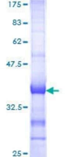 Novus Biologicals Recombinant Human CENTB1 GST (N-Term) Protein 10 &mu;g | Buy Online | Novus Biologicals&trade; | Fisher Scientific