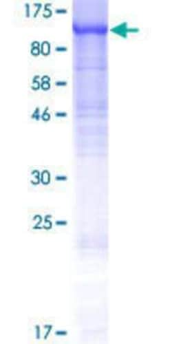 Novus Biologicals Recombinant Human FAM115A GST (N-Term) Protein 10 &mu;g | Buy Online | Novus Biologicals&trade; | Fisher Scientific