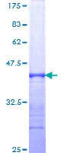 Novus Biologicals Recombinant Human SLK GST (N-Term) Protein 25 &mu;g | Buy Online | Novus Biologicals&trade; | Fisher Scientific