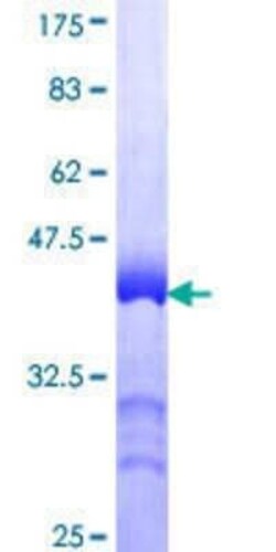 Novus Biologicals Recombinant Human PHACTR2 GST (N-Term) Protein 25 &mu;g | Buy Online | Novus Biologicals&trade; | Fisher Scientific