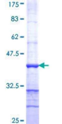 Novus Biologicals Recombinant Human Protocadherin alpha-9 GST (N-Term) Protein 25 &mu;g | Buy Online | Novus Biologicals&trade; | Fisher Scientific