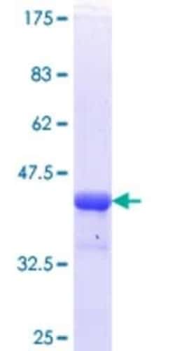 Novus Biologicals Recombinant Human Histone Deacetylase 4/HDAC4 GST (N-Term) Protein 10 &mu;g | Buy Online | Novus Biologicals&trade; | Fisher Scientific