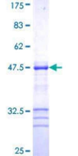 Novus Biologicals Recombinant Human ZFYVE16 GST (N-Term) Protein 10 &mu;g | Buy Online | Novus Biologicals&trade; | Fisher Scientific