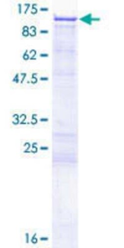 Novus Biologicals Recombinant Human Matrin 3 GST (N-Term) Protein 2 &mu;g | Buy Online | Novus Biologicals&trade; | Fisher Scientific