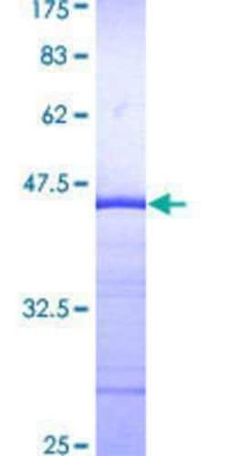 Novus Biologicals Recombinant Human MTSS1 GST (N-Term) Protein 10 &mu;g | Buy Online | Novus Biologicals&trade; | Fisher Scientific