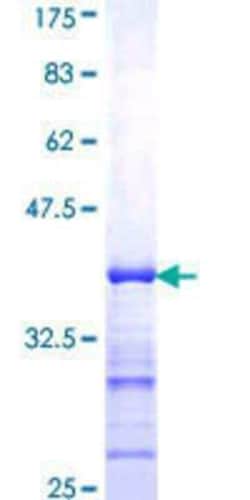 Novus Biologicals Recombinant Human MAmL1 GST (N-Term) Protein 10 &mu;g | Buy Online | Novus Biologicals&trade; | Fisher Scientific
