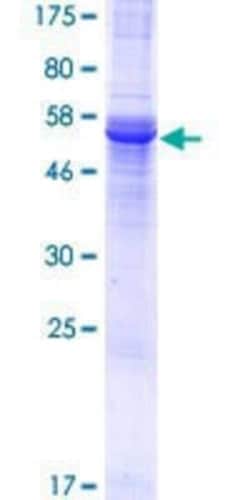 Novus Biologicals Recombinant Human PHYHIP GST (N-Term) Protein 10 &mu;g | Buy Online | Novus Biologicals&trade; | Fisher Scientific