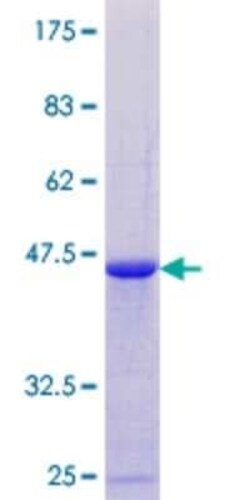 Novus Biologicals Recombinant Human DAZAP2 GST (N-Term) Protein 10 &mu;g | Buy Online | Novus Biologicals&trade; | Fisher Scientific